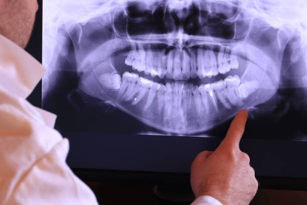 Best Mobile Emergency Dentist in Englishtown, NJ